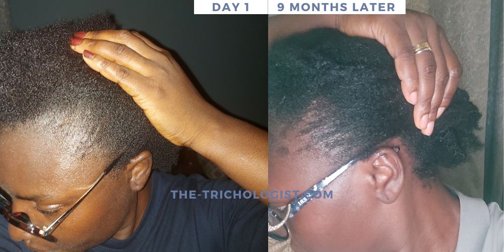 Atilola The Trichologist Client Testimonial 11