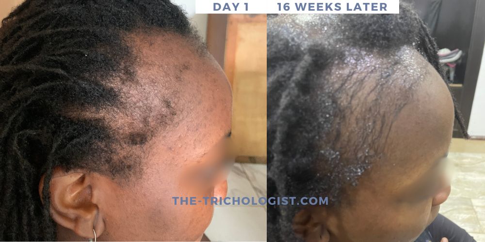 Atilola The Trichologist Client Testimonial 12