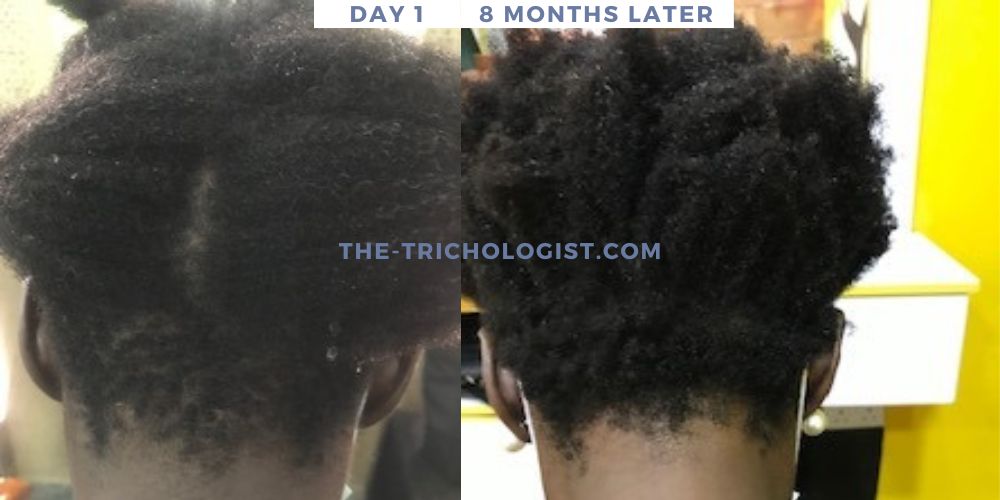 Atilola The Trichologist Client Testimonial 13