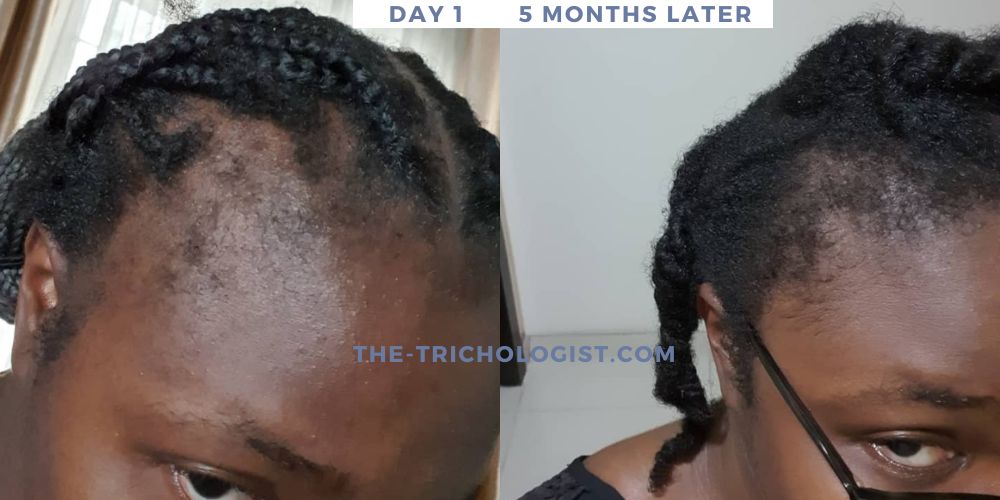 Atilola The Trichologist Client Testimonial 14