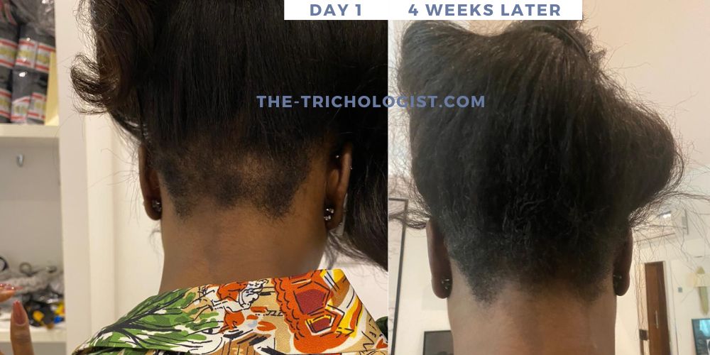 Atilola The Trichologist Client Testimonial 15