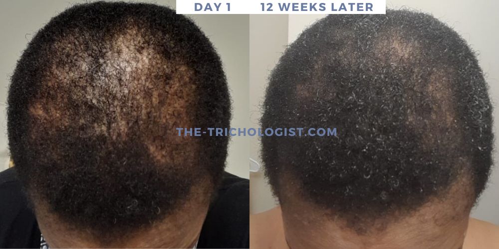 Atilola The Trichologist Client Testimonial 2