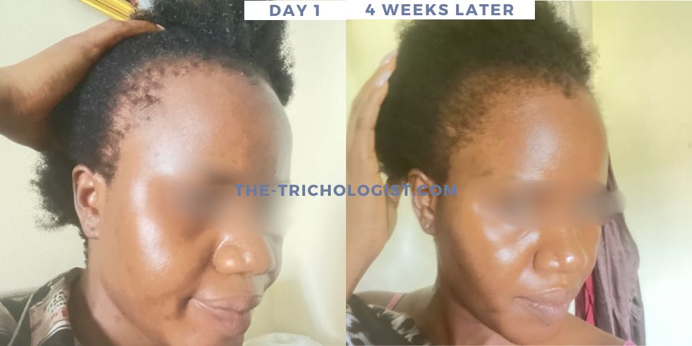 Atilola The Trichologist Client Testimonial 3