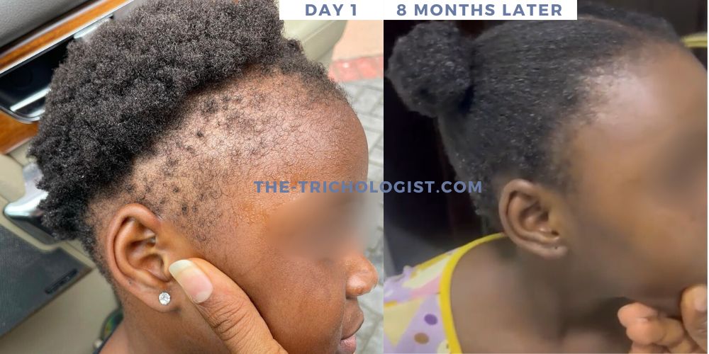 Atilola The Trichologist Client Testimonial 4