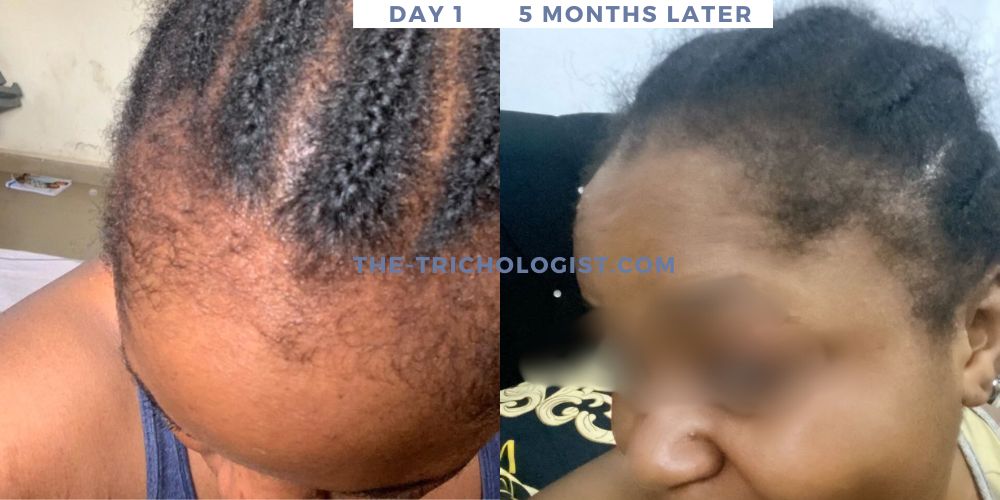 Atilola The Trichologist Client Testimonial 5