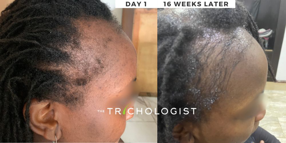 Atilola The Trichologist - Client Testimonial 12