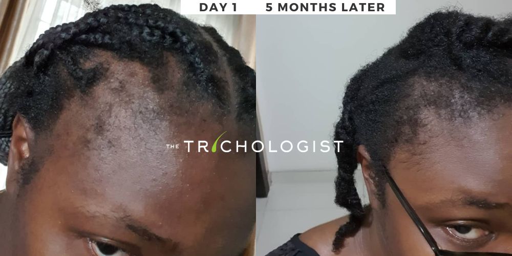 Atilola The Trichologist - Client Testimonial 14