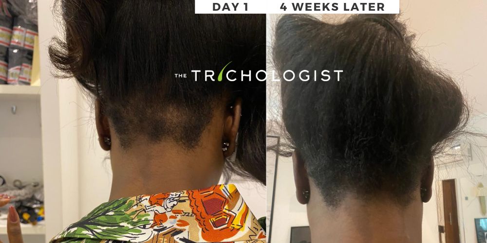 Atilola The Trichologist - Client Testimonial 15