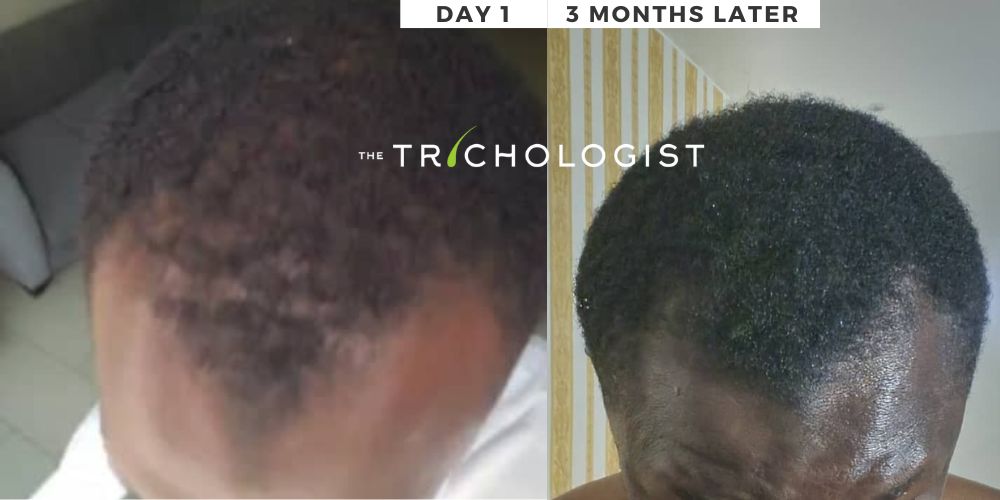 Atilola The Trichologist - Client Testimonial 18