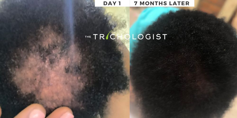 Atilola The Trichologist - Client Testimonial 19