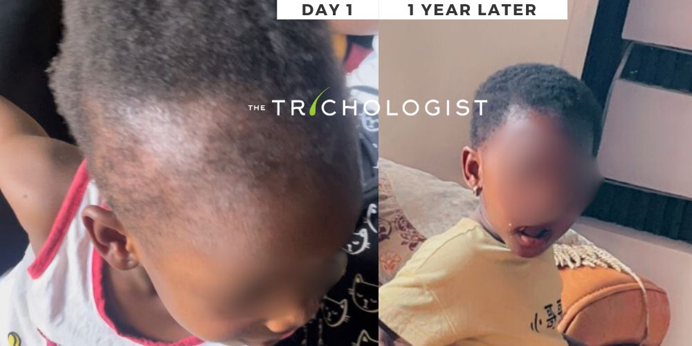 Atilola The Trichologist - Client Testimonial 20