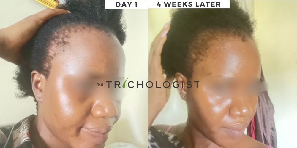 Atilola The Trichologist - Client Testimonial 3