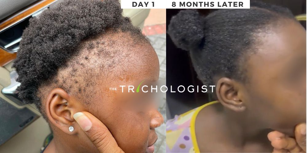 Atilola The Trichologist - Client Testimonial 4