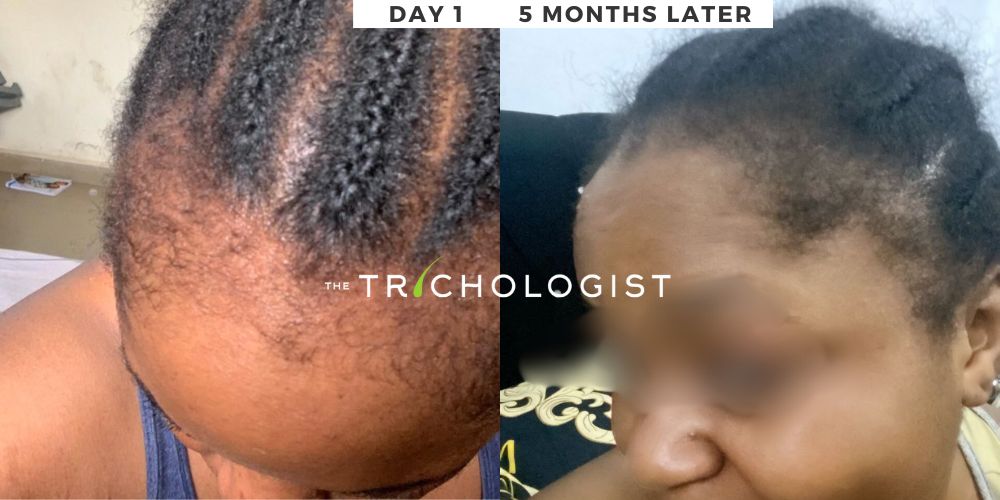 Atilola The Trichologist - Client Testimonial 5