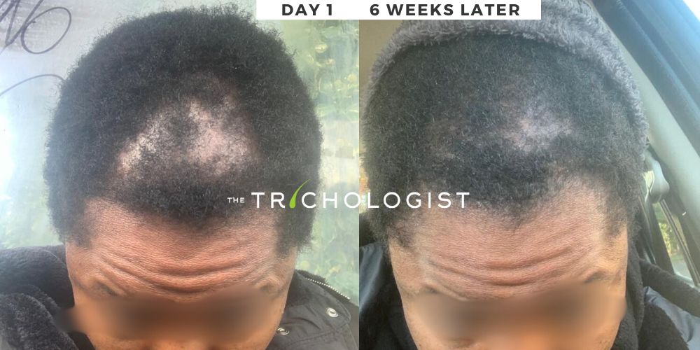 Atilola The Trichologist - Client Testimonial 6