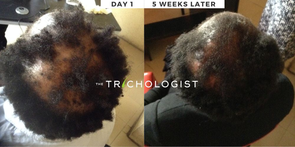 Atilola The Trichologist - Client Testimonial 8