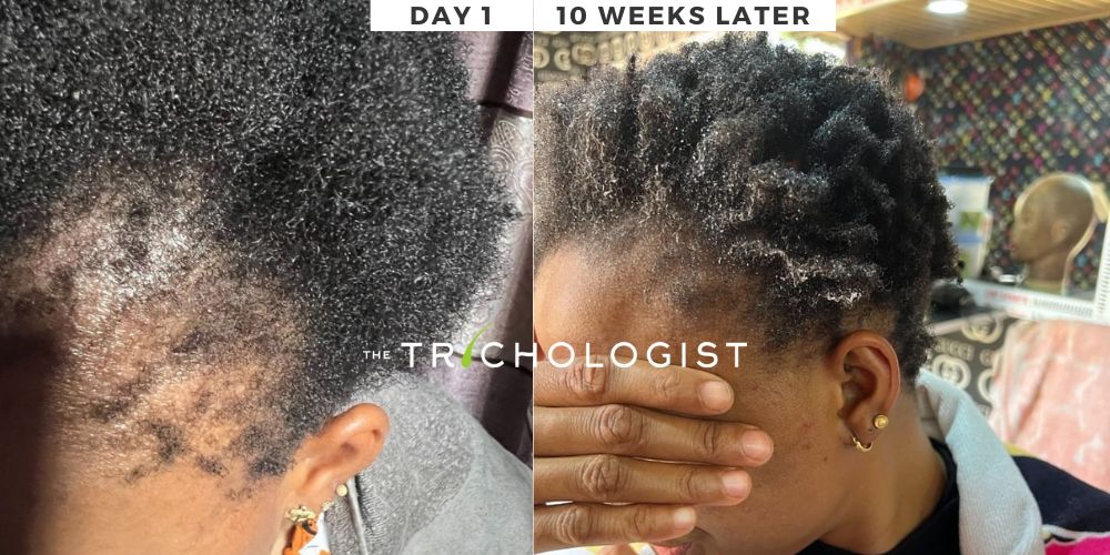 Atilola The Trichologist - Client Testimonial 9